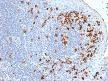 Kappa Light Chain Antibody