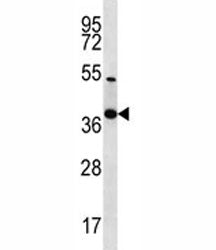 NKX2.2 Antibody