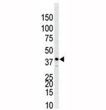 p38 Antibody (MAPK14)