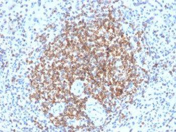 Bcl-2 Antibody
