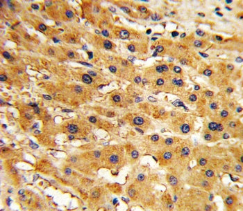 APRT Antibody