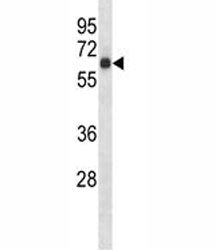 S6k1 Antibody