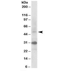FBXW2 Antibody