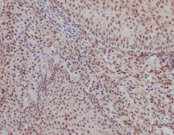 IHC staining of FFPE human tonsil tissue with Ku70 antibody. HIER: boil tissue sections in pH6, 10mM