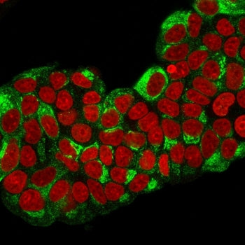Estrogen Inducible Protein pS2 / TFF1 Antibody