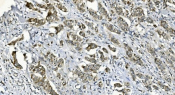 Diacylglycerol kinase zeta Antibody / DGKZ
