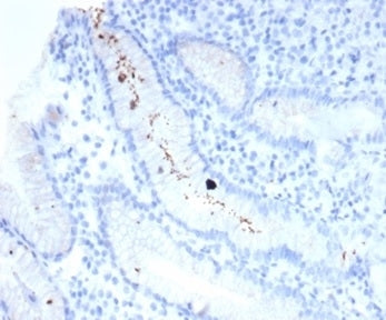 IHC staining of FFPE human H. pylori-infected stomach with Helicobacter pylori (clone HPYL/7225) ant
