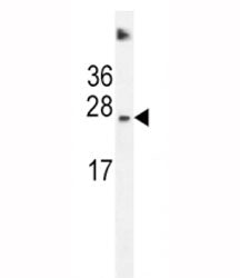 SDHD Antibody