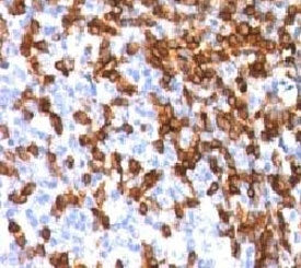Formalin-fixed, paraffin-embedded human tonsil stained with CD44 antibody (clone HCM15-1). FFPE test