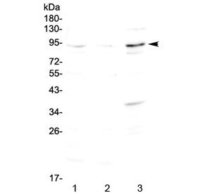Western blot testing of 1) rat brain, 2) mouse brain and 3) human SK-OV-3 lysate with FOXP2 antibody