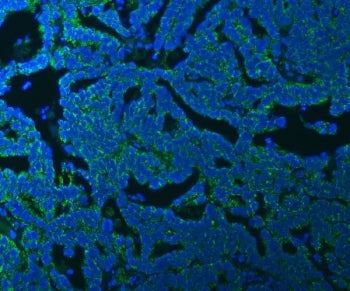 Immunofluorescent staining of FFPE human ovarian cancer tissue with SSBP1 antibody (green) and DAPI 