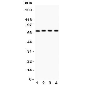 Western blot testing of Neuregulin-1 antibody and Lane 1: MCF-7; 2: SKOV; 3: 22RV1; 4: COLO320 lysat