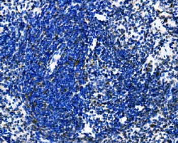 IHC staining of FFPE mouse spleen tissue with Dectin 1 antibody. HIER: boil tissue sections in pH8 E