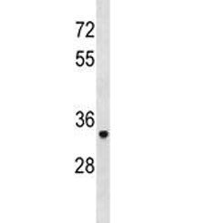 TRAcP Antibody / TRAP / ACP5