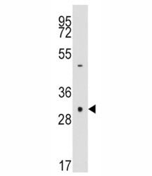 Caspase-3 Antibody, 0.4ml