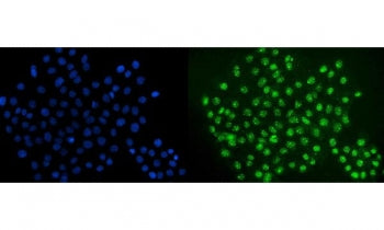 ERG Antibody / Transcriptional regulator ERG
