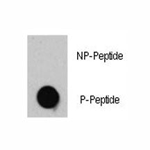 Dot blot analysis of phospho-TSC2 antibody. 50ng of phos-peptide or nonphos-peptide per dot were spo