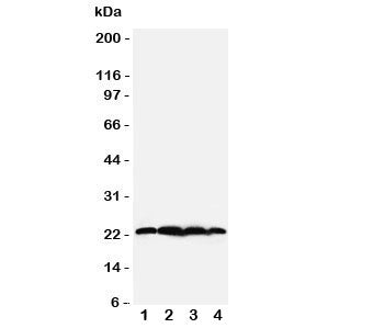 Western blot testing of BAG2 antibody; Lane 1: rat testis; 2: HeLa; 3: A549; 4: A431 cell lysate. Pr
