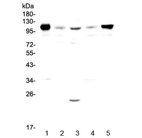 Vcam-1 Antibody