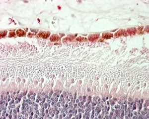 RDH5 Antibody