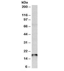Western blot testing of rat pancreas lysate with Sap30l antibody at 0.3g/ml. Predicted molecular wei