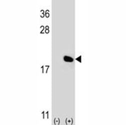 Western blot analysis of IL-17 antibody and 293 cell lysate (2 ug/lane) either nontransfected (Lane 