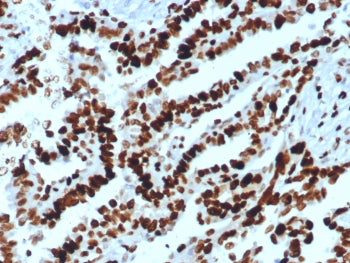 MCM2 Antibody