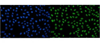 Immunofluorescent staining of FFPE human U-2 OS cells with IGF2-AS antibody (green) and DAPI nuclear