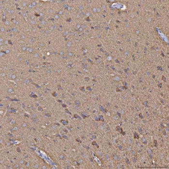 IHC staining of FFPE rat brain tissue with Selenophosphate synthetase 1 antibody. HIER: boil tissue 
