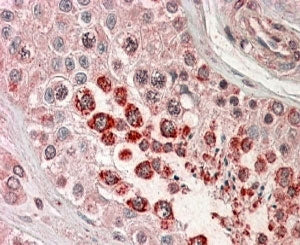 XAGE1 Antibody (isoform d)
