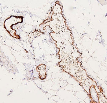 IHC staining of FFPE human skeletal muscle with Filamin A antibody. HIER: boil tissue sections in pH