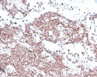 MGMT Antibody