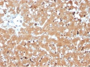 IHC staining of FFPE human liver tissue with Haptoglobin antibody (clone HP/3835) at 2ug/ml. HIER: b