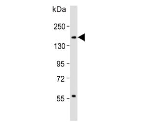 Western blot testing of human spleen lysate with CD11b antibody. Expected molecular weight: 128-170 