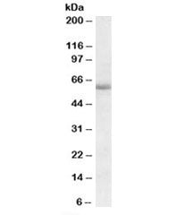 Cadherin 23 Antibody