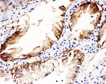 ITGB4 Antibody