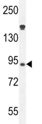 Myeloperoxidase Antibody