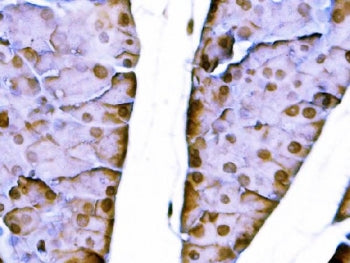 IHC staining of FFPE mouse pancreas tissue with Sox11 antibody. HIER: boil tissue sections in pH8 ED