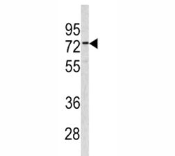 CEA Antibody