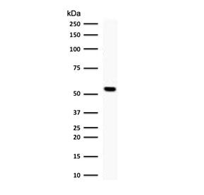 TOP1MT Antibody / Topoisomerase I mitochondrial
