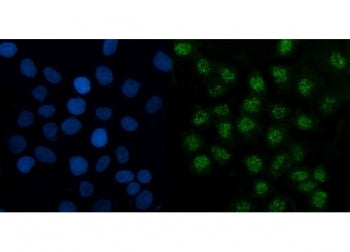 Immunofluorescent staining of FFPE human A431 cells with TMED5 antibody (green) and DAPI nuclear sta