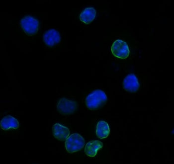 Immunofluorescent staining of FFPE mouse RAW264.7 cells with Il2r alpha antibody (green) and DAPI nu