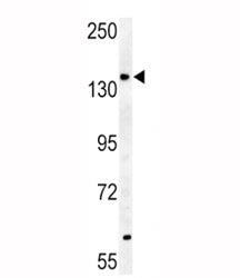 ABCB4 Antibody