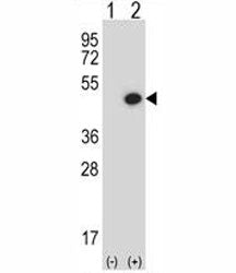 Western blot analysis of BMP7 antibody and 293 cell lysate either nontransfected (Lane 1) or transie
