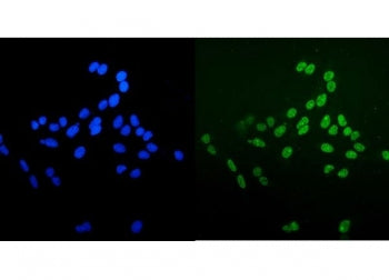 Ku70/XRCC6 Antibody