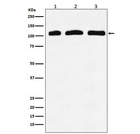 PI 3 Kinase p110 delta Antibody / PIK3CD