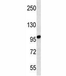 STIM2 antibody western blot analysis in uterus tumor lysate. Predicted molecular weight: 84/94/68 kD