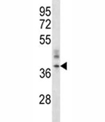 CRACM1 Antibody