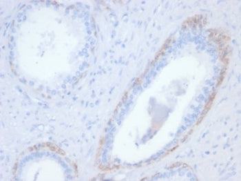 IHC staining of FFPE human prostate tissue with recombinant KRT14 antibody (clone rKRT14/7368). HIER