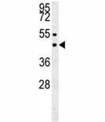 SUV39H1 Antibody